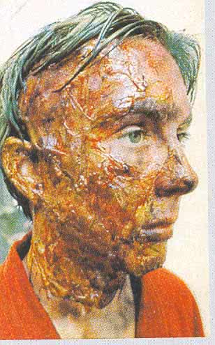 Gelafix Transparent -Unfall Make Up-Halloween Schminke